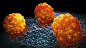 Deciphering the Immunogenomic Landscape in Melanoma